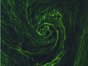 Eye_of_an_algal_storm_large_Sentinel2